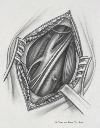 neck, instruments, muscles, nerves, blood vessels