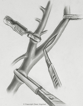 neck, instruments, blood vessels, scalpel