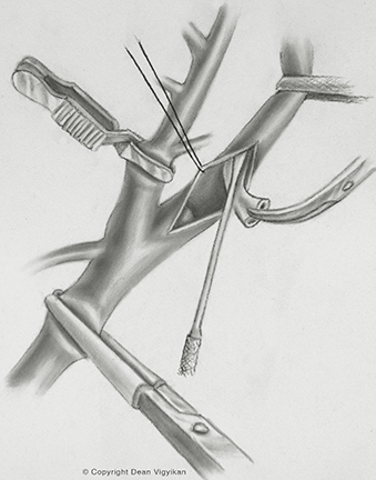 neck, instruments, blood vessels, scalpel