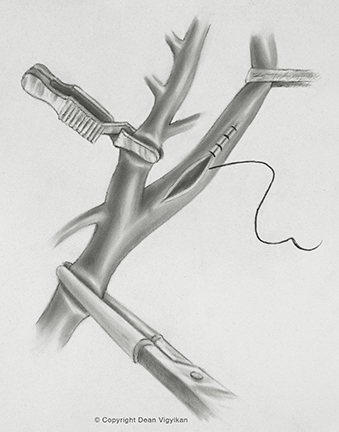 neck, instruments, blood vessels, scalpel
