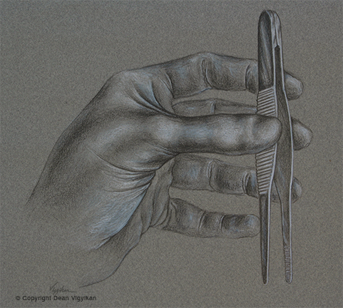 hand, surgery, glove, instrument, tweezers