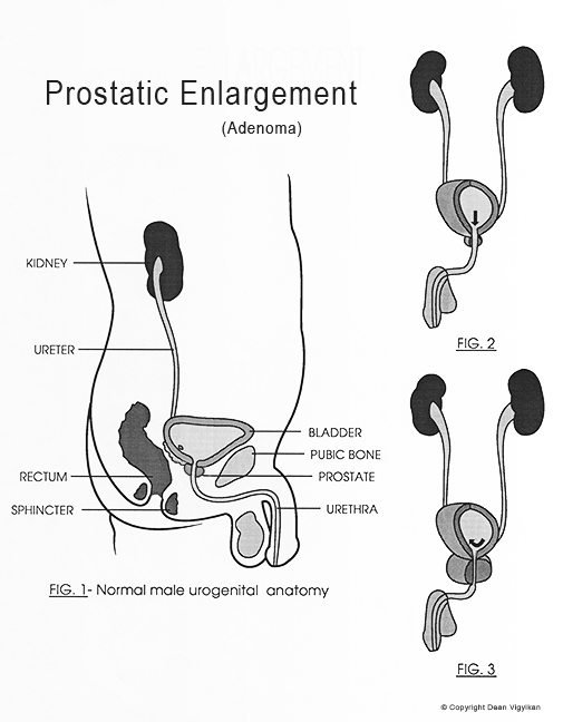 medical, illustration, schematic, diagram, kidney, ureter, excretory, genetalia