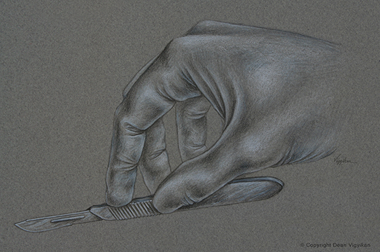 hand, surgery, glove, instrument, knife